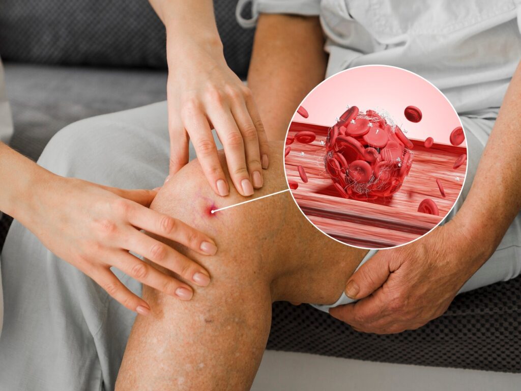 Bone Marrow Transplantation Center facilities and care