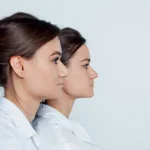 double jaw surgery