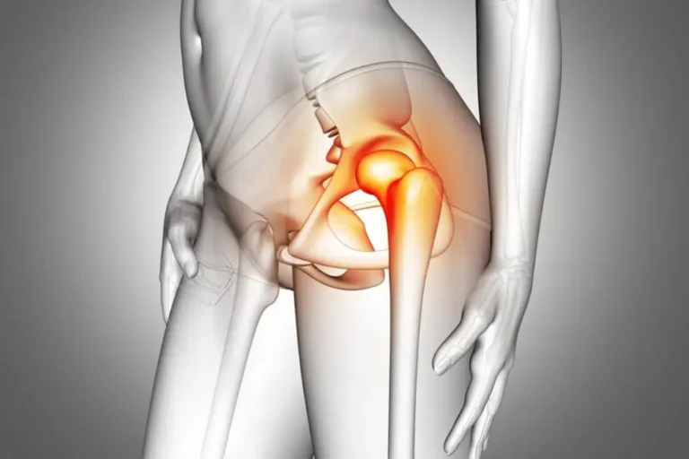 Robotic Sacrocolpopexy: Pelvic Prolapse Treatment