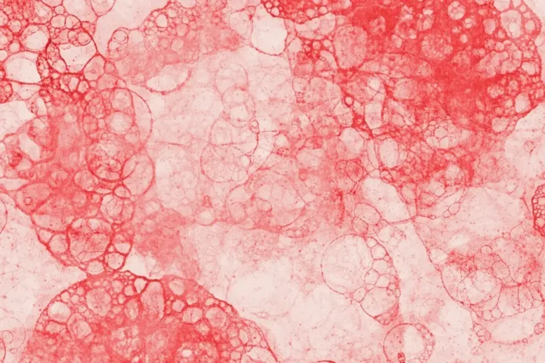 What Does a Low WBC and Kidney Transplant Mean?