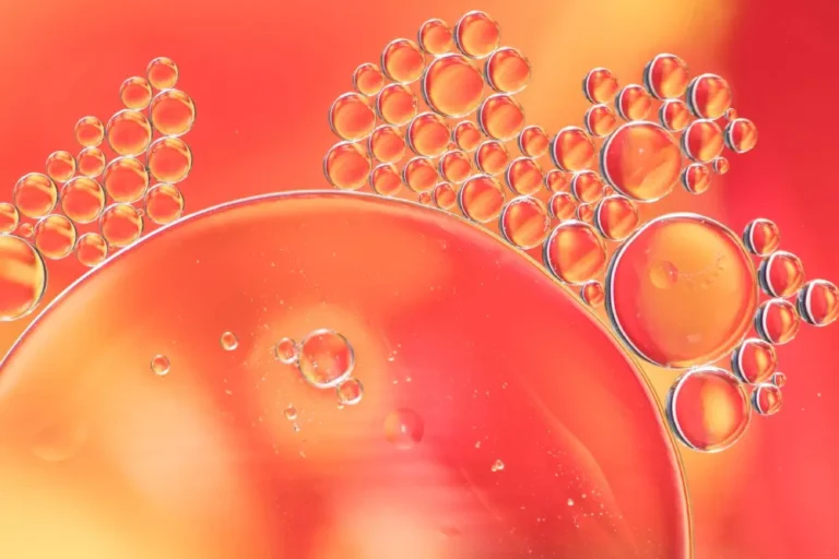 How does cystic fibrosis affect amino acids in the body