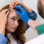 Hair transplant for women – procedure, benefits, and results