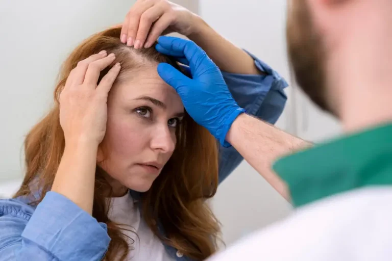 Hair transplant for women – procedure, benefits, and results