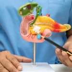 atrophic pancreas​