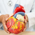 abdominal aortic aneurysm