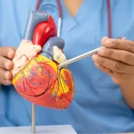 Coronary Artery Bypass
